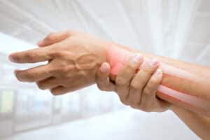 Person, in need of thumb arthritis surgery, gripping hand and wrist.